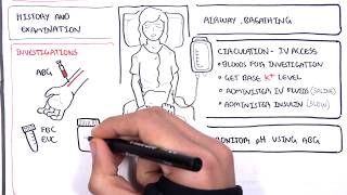 Diabetic Ketoacidosis Diabetes Type I Management Summary [upl. by Ynnaffit]