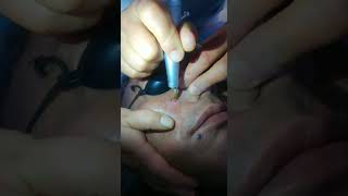 Sparsh Skin Hair amp Laser Clinic [upl. by Siletotsira]