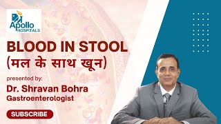 Blood with stoolMal ke sath khoon Dr Shravan Bohra Gastroenterologist Apollo hospitals Ahmedabad [upl. by Atnoek]