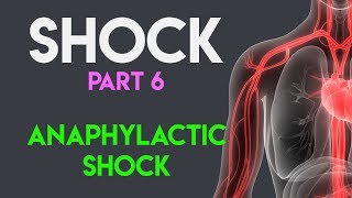 Anaphylactic Shock  Shock Part 6 [upl. by Annawaj]