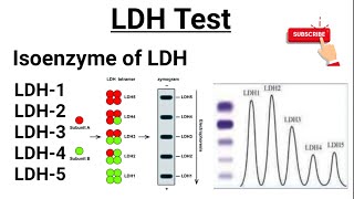 LDH Test  Isoenzymes of LDH  Functions of LDH [upl. by Pris]