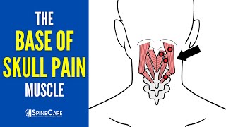 The Base of the Skull Pain Muscle How to Release It for INSTANT RELIEF [upl. by Etteiluj]