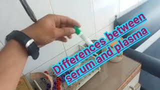 Separation of Human Blood Components by Centrifugation Process  Grade 812  Biology Demo [upl. by Ennayelhsa]