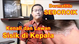 Dematitis SEBOROIK Sisik membandel di kulit kepala Begini cara cegah dan menanganinya [upl. by Eenet830]