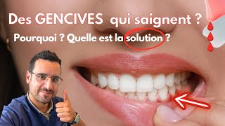 Explication GENCIVE qui SAIGNE  la solution [upl. by Jewel]