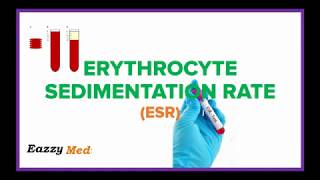 Erythrocyte Sedimentation Rate ESR Made Simple [upl. by Ruomyes]