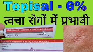 Topisal  6 Uses in Hindi  Clobetasol Propionate and Salicylic Acid Ointment [upl. by Tierza]