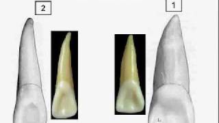 Dentition Identification121part1of3m4v [upl. by Ensign84]