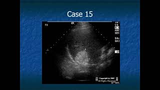 RADIOLOGY EXAM CASES [upl. by Ballard]