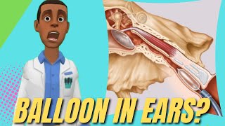 Eustachian Tube Dysfunction Balloon Dilation  Pros and Cons [upl. by Keil]