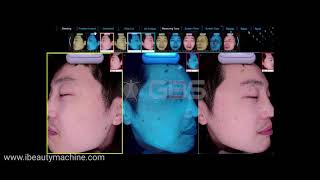 HiRes Smart Face Mirror System Demo  skin analysis machine  skin analyser  facial skin analyzer [upl. by Hardi926]