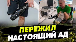 Кадыровцы АМПУТИРОВАЛИ ВСЕ ЧЕТЫРЕ конечности В это СЛОЖНО ПОВЕРИТЬ история украинского защитника [upl. by Bloch]