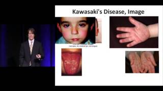 ERBC 8 Pediatric Rashes [upl. by Alejna]