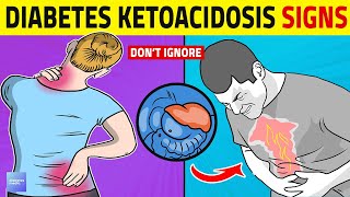 Diabetic Ketoacidosis Warning Signs You Should Know [upl. by Roberto]