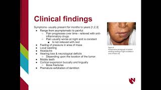 Chondrosarcoma [upl. by Bobbi]