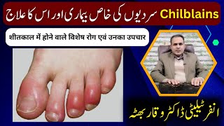 Chilblains Causes Symptoms and Homeopathic Treatments by Dr Waqar Bhutta [upl. by Ancilin278]