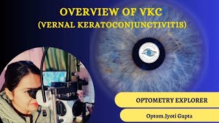 Vernal Keratoconjunctivits VKC VKC [upl. by Sel]