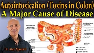 Autointoxication Toxins in the Colon  A Major Cause of Pain Sickness and Disease  Dr Mandell [upl. by Cleaves461]