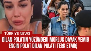 Dilan Polat ve Engin Polat Tek Celsede Boşanıyor Şiddet İddiaları ve Şok Eden Gerçekler [upl. by Afton93]