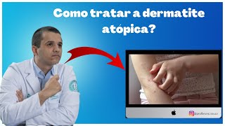 Dermatite atópica como aliviar a coceira [upl. by Retsevlis]