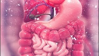 Intestinal obstruction part 2 and Benign tumor of intestine [upl. by Senecal]