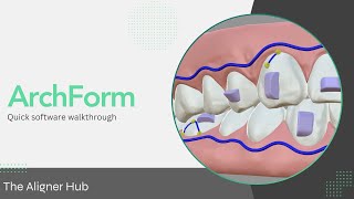 Archform Software Walkthrough [upl. by Eceinwahs]