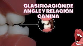 Clasificación de Angle y relación canina [upl. by Blackington367]