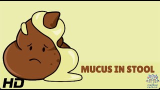 Mucus In Stool Everything You Need To Know [upl. by Eitirahc938]