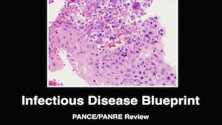 Infectious Disease Preview PANCE PANRE Review Courses [upl. by Donough950]