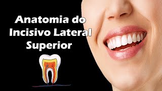 Aula de Anatomia Dental  Anatomia do Incisivo Lateral Superior  Dente 12 e 22 [upl. by Charlene]