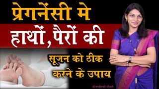 प्रेगनेंसी में हाथों पैरों की सूजन को ठीक करने के उपाय। OEDEMA IN PREGNANCY hindi [upl. by Allys]