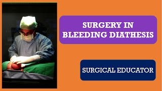 SURGERY IN BLEEDING DIATHESIS [upl. by Westberg]