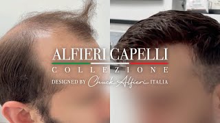 Chuck Alfieri Capelli  Hair Replacement for Men Incredible Transformation [upl. by Sundberg81]