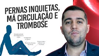 Síndrome das pernas inquietas quais os riscos e sua relação com a má circulação trombose e embolia [upl. by Anaylil]