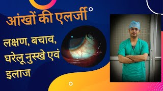 Allergic conjunctivitis eye allergy redness itching watering causes home remedies and treatment [upl. by Yendis]