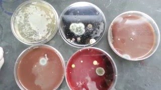 Fungal contaminated various culture plates [upl. by Matt]