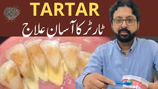 How to Remove TARTAR from Teeth at Home Naturally [upl. by Drarehs454]