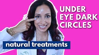 Eye Doctor Explains How To Get Rid Of Dark Under Eye Circles Naturally [upl. by Vorster]