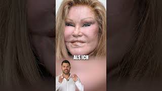 Jocelyn Wildenstein Die Katzenfrau 😱jocelynwildenstein katzenfrau frühervsheute beautydoc [upl. by Steere53]