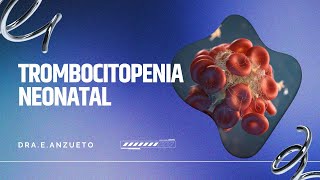 TROMBOCITOPENIA NEONATAL Dr E Anzueto [upl. by Loftis]