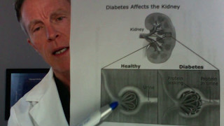 How to Test for Cardiovascular Inflammation Microalbumin Creatinine Ratio [upl. by Weight]