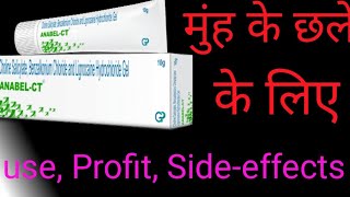 AnabelCT gel choline SalicylateBenzalkonium Lignocaine hydrochloride use Profit Sideeffects [upl. by Akihsal]