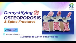 🦴📚Latest Osteoporosis Treatment amp Spine Fractures What a Physician Must Know👨‍⚕️🦴 [upl. by Ellenig]