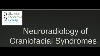 Neuroradiology of Craniofacial Syndromes craniosynostosis and beyond [upl. by Jephthah]