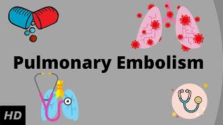 Pulmonary embolism Causes Signs and Symptoms Diagnosis and Treatment [upl. by Nnaer]