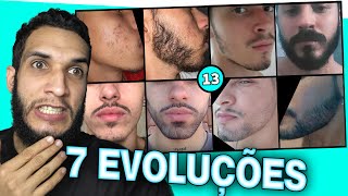 7 EVOLUÇÕES COM MINOXIDIL 13 [upl. by Ameerahs104]