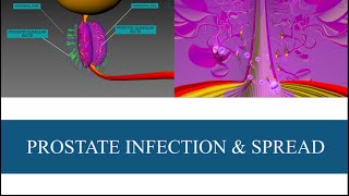 Microbes in the Prostate  Prostatitis amp STIs [upl. by Gilder]