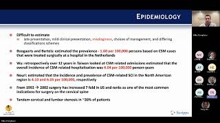 Cervical Spondylotic Myelopathy presented by Michael Pompliano MD on April 1 2024 [upl. by Ycnaffit293]