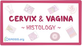 Cervix and vagina Histology [upl. by Ritter976]