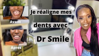 TRAITEMENT DR SMILE Dents du bonheur resserrer en 5mois gouttières invisibles prix douleurs [upl. by Adrahs]